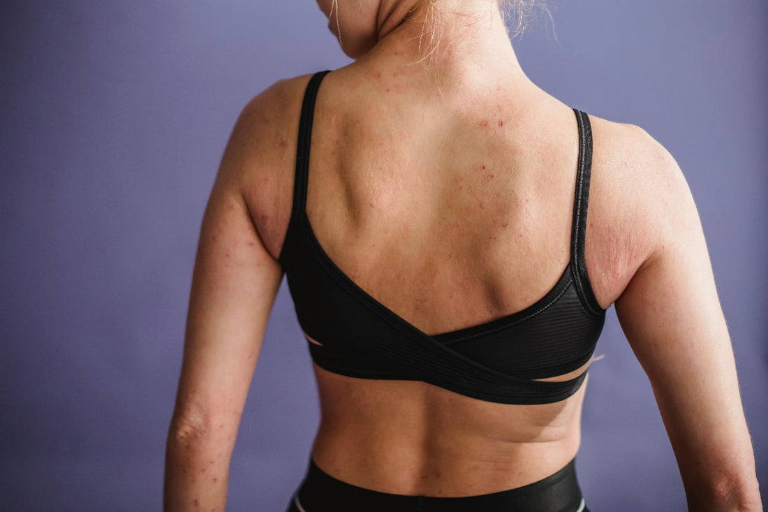Targeting Specific Skin Concerns with Body Moisturisers